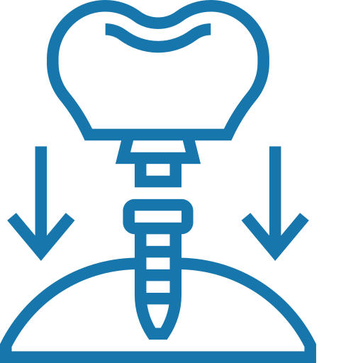 Teeth Implants
